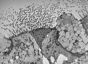 M,22y. | normal bronchial epithelium